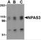 Neuronal PAS Domain Protein 3 antibody, 4107, ProSci, Western Blot image 