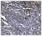 Endoplasmic reticulum aminopeptidase 2 antibody, A04269-1, Boster Biological Technology, Immunohistochemistry paraffin image 