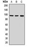 Transient Receptor Potential Cation Channel Subfamily C Member 3 antibody, orb412655, Biorbyt, Western Blot image 