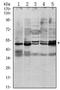 SMAD Family Member 3 antibody, AM06479SU-N, Origene, Western Blot image 