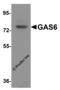 Growth Arrest Specific 6 antibody, 8365, ProSci, Western Blot image 