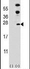 Dual Specificity Phosphatase 14 antibody, PA5-15566, Invitrogen Antibodies, Western Blot image 