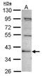 C2 Calcium Dependent Domain Containing 2 antibody, NBP2-15647, Novus Biologicals, Western Blot image 