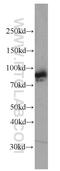 Phosphoinositide-3-Kinase Regulatory Subunit 6 antibody, 55311-1-AP, Proteintech Group, Western Blot image 