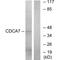 Cell division cycle-associated protein 7 antibody, A07777, Boster Biological Technology, Western Blot image 