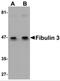 EGF Containing Fibulin Extracellular Matrix Protein 1 antibody, 5213, ProSci Inc, Western Blot image 