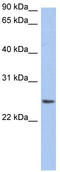 Neurensin-2 antibody, TA338691, Origene, Western Blot image 