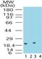 Dual Specificity Phosphatase 18 antibody, NB100-56481, Novus Biologicals, Western Blot image 