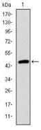 Troponin I2, Fast Skeletal Type antibody, NBP2-37551, Novus Biologicals, Western Blot image 