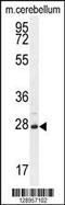 V-Set And Transmembrane Domain Containing 2A antibody, 55-686, ProSci, Western Blot image 
