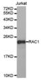 Rac Family Small GTPase 1 antibody, abx002103, Abbexa, Western Blot image 