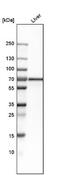 Bile acyl-CoA synthetase antibody, NBP1-89267, Novus Biologicals, Western Blot image 