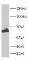 Chromosome 7 Open Reading Frame 31 antibody, FNab01135, FineTest, Western Blot image 