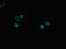 Solute Carrier Family 2 Member 2 antibody, orb46259, Biorbyt, Immunocytochemistry image 
