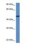 SWI/SNF-related matrix-associated actin-dependent regulator of chromatin subfamily D member 3 antibody, NBP1-79718, Novus Biologicals, Western Blot image 