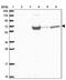 Pre-MRNA Processing Factor 38B antibody, PA5-62766, Invitrogen Antibodies, Western Blot image 