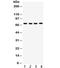 Solute Carrier Family 6 Member 4 antibody, R32067, NSJ Bioreagents, Western Blot image 