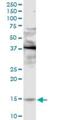 Phospholipase A2 Group IIE antibody, H00030814-D01P, Novus Biologicals, Western Blot image 