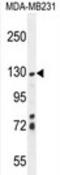 Zinc Finger SWIM-Type Containing 6 antibody, AP54741PU-N, Origene, Western Blot image 