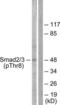 HsMAD2 antibody, LS-C199584, Lifespan Biosciences, Western Blot image 