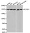 SET Domain Bifurcated Histone Lysine Methyltransferase 1 antibody, LS-C331203, Lifespan Biosciences, Western Blot image 