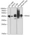 Pyruvate Dehydrogenase E1 Alpha 2 Subunit antibody, 23-990, ProSci, Western Blot image 
