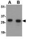 Protein NipSnap homolog 1 antibody, GTX85406, GeneTex, Western Blot image 