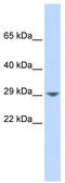 Potassium Calcium-Activated Channel Subfamily N Member 2 antibody, TA338745, Origene, Western Blot image 