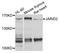 Jumonji And AT-Rich Interaction Domain Containing 2 antibody, A9823, ABclonal Technology, Western Blot image 