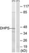 Deoxyhypusine synthase antibody, TA311933, Origene, Western Blot image 
