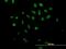 A-Kinase Anchoring Protein 17A antibody, H00008227-B01P, Novus Biologicals, Immunofluorescence image 