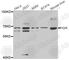 Polymeric immunoglobulin receptor antibody, A6130, ABclonal Technology, Western Blot image 