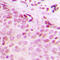 Extra Spindle Pole Bodies Like 1, Separase antibody, LS-C354138, Lifespan Biosciences, Immunohistochemistry paraffin image 