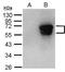 Epstein Barr Virus Protein 71 antibody, PA5-32202, Invitrogen Antibodies, Western Blot image 