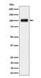 Spectrin Repeat Containing Nuclear Envelope Family Member 3 antibody, M13164, Boster Biological Technology, Western Blot image 