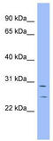 Hairy/enhancer-of-split related with YRPW motif protein 1 antibody, TA346067, Origene, Western Blot image 