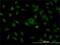 Stromal Antigen 1 antibody, H00010274-M01, Novus Biologicals, Immunocytochemistry image 