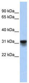 KDEL Endoplasmic Reticulum Protein Retention Receptor 3 antibody, TA341866, Origene, Western Blot image 