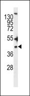 Zinc Finger DHHC-Type Containing 20 antibody, PA5-48558, Invitrogen Antibodies, Western Blot image 