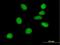 ATM Interactor antibody, H00023300-B01P, Novus Biologicals, Immunocytochemistry image 