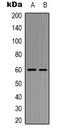 Akt antibody, LS-C413186, Lifespan Biosciences, Western Blot image 
