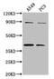 V-type proton ATPase subunit d 2 antibody, CSB-PA818735LA01HU, Cusabio, Western Blot image 