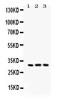 BCL10 Immune Signaling Adaptor antibody, PB9525, Boster Biological Technology, Western Blot image 
