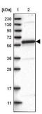 FA Core Complex Associated Protein 100 antibody, NBP1-90468, Novus Biologicals, Western Blot image 
