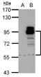 cAMP-specific 3 ,5 -cyclic phosphodiesterase 4D antibody, LS-C185640, Lifespan Biosciences, Western Blot image 