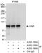 Cold Shock Domain Containing E1 antibody, A303-159A, Bethyl Labs, Immunoprecipitation image 