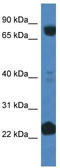 Cullin 3 antibody, TA343139, Origene, Western Blot image 