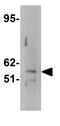FTO Alpha-Ketoglutarate Dependent Dioxygenase antibody, GTX85019, GeneTex, Western Blot image 