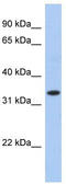 SPY1 antibody, TA339691, Origene, Western Blot image 