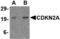 Cyclin-dependent kinase inhibitor 2A, isoform 1 antibody, TA306428, Origene, Western Blot image 